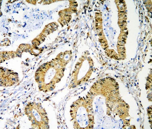 Anti-PRMT1 Antibody Picoband® Boster Bio