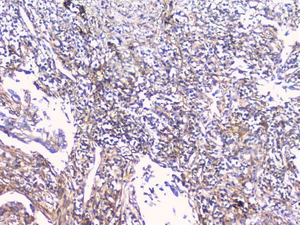 Anti-FCGR2A Antibody Picoband® Boster Bio