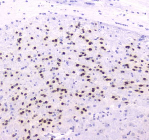 Anti-strogen Related Receptor gamma/ESRRG Antibody Picoband® Boster Bio