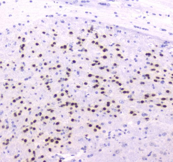 Anti-strogen Related Receptor gamma/ESRRG Antibody Picoband® Boster Bio