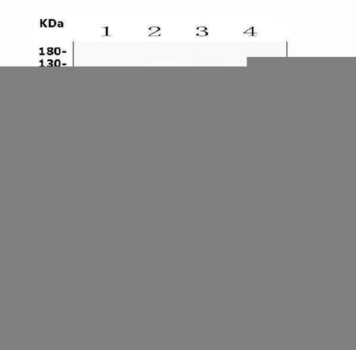 Anti-ABCG8 Antibody Picoband® Boster Bio