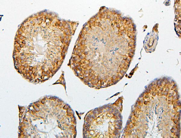 Anti-CRB1 Antibody Picoband® Boster Bio