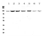 Anti-SMC6L1 Antibody Picoband® Boster Bio