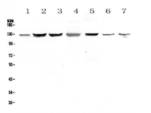 Anti-SMC6L1 Antibody Picoband® Boster Bio