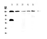 Anti-NEDD4-2/NEDD4L Antibody Picoband® Boster Bio