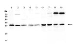 Anti-RAB27A Antibody Picoband® Boster Bio