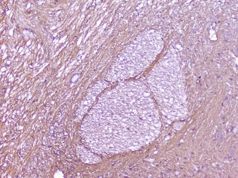 Anti-SNAP25 Antibody Picoband® Boster Bio