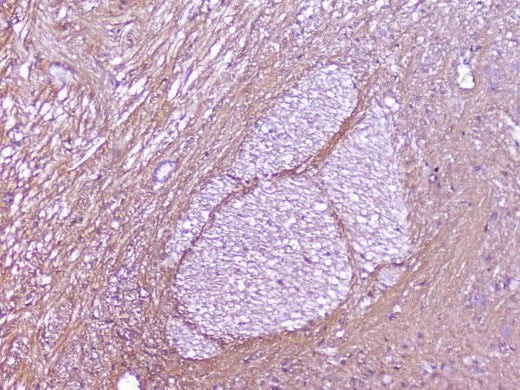 Anti-SNAP25 Antibody Picoband® Boster Bio