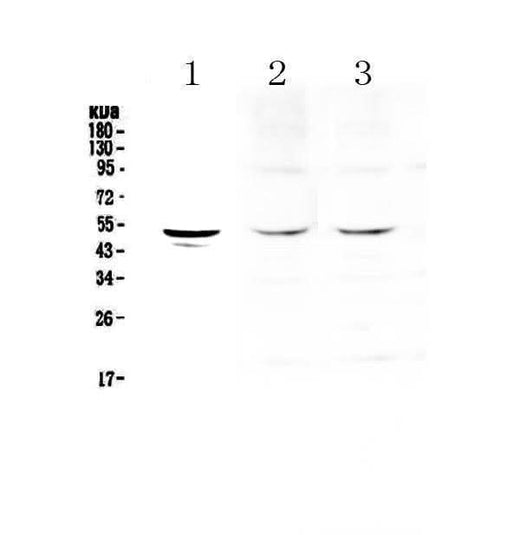 Anti-Tryptophan Hydroxylase/TPH1 Antibody Picoband® Boster Bio