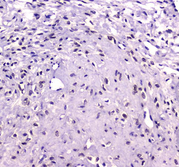 Anti-RUNX1T1/ETO Antibody Picoband® Boster Bio