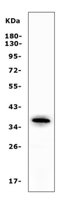 Anti-Apolipoprotein L1/APOL1 Antibody Picoband® Boster Bio