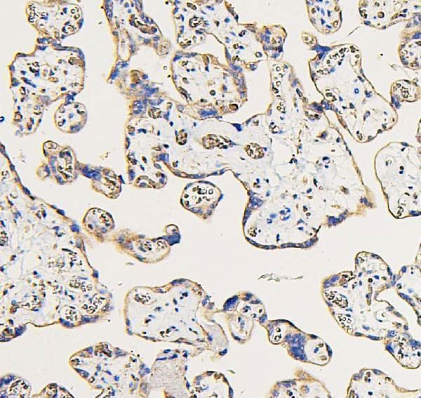 Anti-IFNAR2 Antibody Picoband® Boster Bio