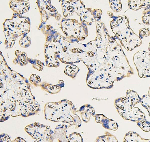 Anti-IFNAR2 Antibody Picoband® Boster Bio