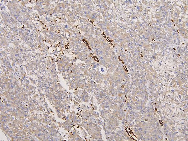 Anti-Glycophorin A/GYPA Antibody Picoband® Boster Bio