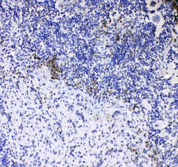 Anti-CD8 alpha/Cd8a Antibody Picoband® Boster Bio