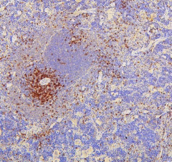 Anti-CD8 alpha/Cd8a Antibody Picoband® Boster Bio