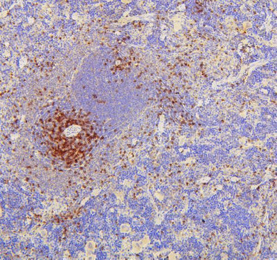 Anti-CD8 alpha/Cd8a Antibody Picoband® Boster Bio
