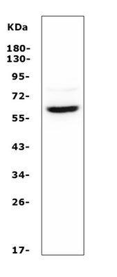 Anti-ASIC1 Antibody Picoband® Boster Bio