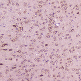 Anti-Calcitonin/Calca Antibody Boster Bio