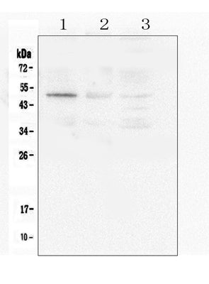 Anti-Caspase-2/CASP2 Antibody Picoband® Boster Bio