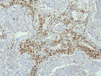 Anti-EBP50/NHERF-1/SLC9A3R1 Antibody Picoband® Boster Bio