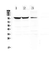 Anti-Dynamin 1/DNM1 Antibody Picoband® Boster Bio