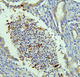 Anti-NRAMP1/SLC11A1 Antibody Picoband® Boster Bio