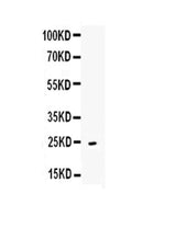 Anti-CD252/Tnfsf4 Antibody Picoband® Boster Bio