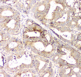Anti-Aprt Antibody Picoband® Boster Bio