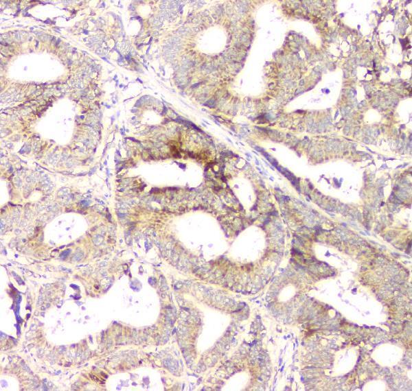 Anti-Aprt Antibody Picoband® Boster Bio