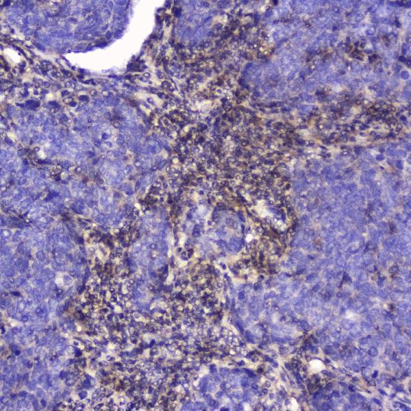 Anti-Talin 1/TLN1 Antibody Picoband® Boster Bio
