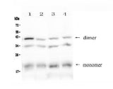 Anti-BAFF Receptor/Tnfrsf13c Antibody Picoband® Boster Bio