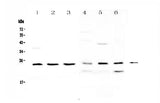 Anti-RAB6A Antibody Picoband® Boster Bio