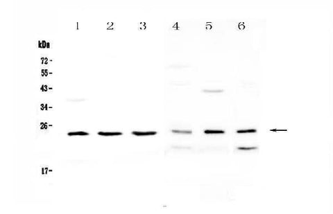 Anti-RAB6A Antibody Picoband® Boster Bio