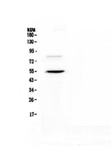 Anti-ANGPTL3 Antibody Picoband® Boster Bio