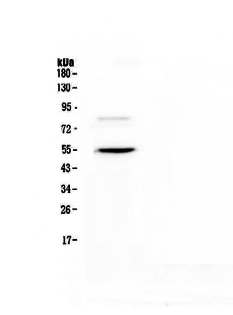 Anti-ANGPTL3 Antibody Picoband® Boster Bio