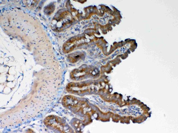 Anti-GALNS Antibody Picoband® Boster Bio