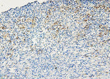 Anti-ABCB5 Antibody Picoband® Boster Bio