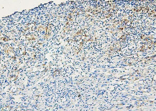 Anti-ABCB5 Antibody Picoband® Boster Bio