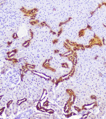 Anti-Calbindin/CALB1 Antibody Picoband® Boster Bio
