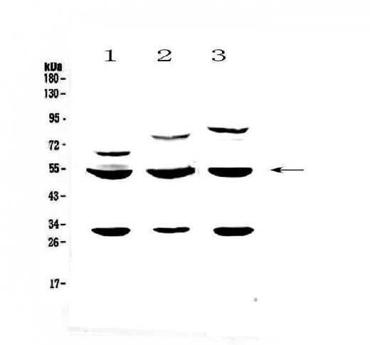 Anti-GSK3 alpha/GSK3A Antibody Picoband® Boster Bio