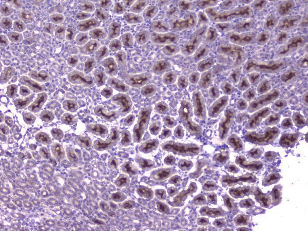 Anti-CCL8 Antibody Boster Bio