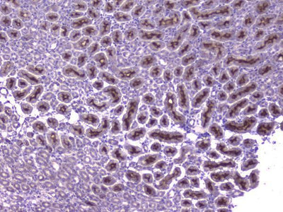 Anti-CCL8 Antibody Boster Bio