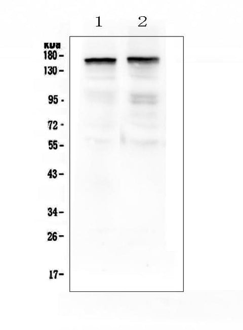 Anti-Thrombospondin 2/THBS2 Antibody Picoband® Boster Bio