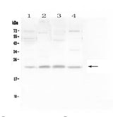 Anti-LMO2 Antibody Picoband® Boster Bio