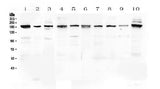 Anti-PCDH15 Antibody Picoband® Boster Bio