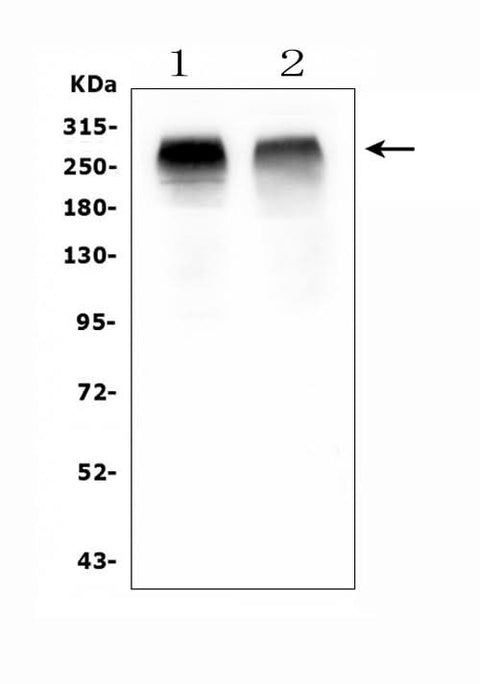 Anti-Acetyl Coenzyme A Carboxylase/ACACB Antibody Picoband® Boster Bio