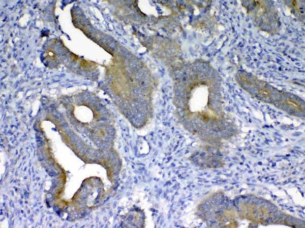 Anti-MMP10 Antibody Picoband® Boster Bio