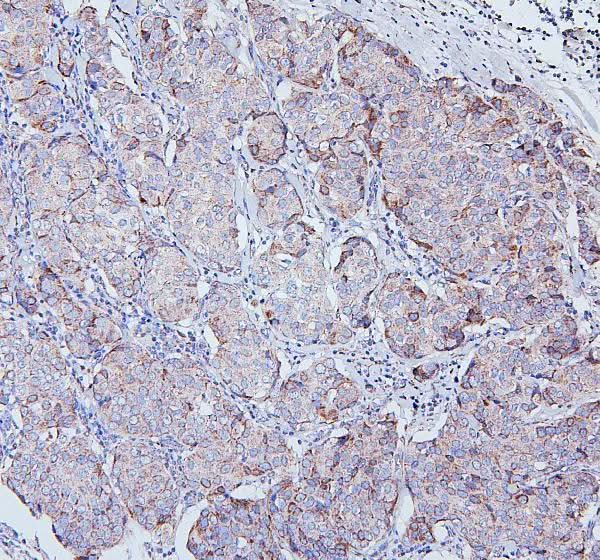 Anti-TRPV3 Antibody Picoband® Boster Bio
