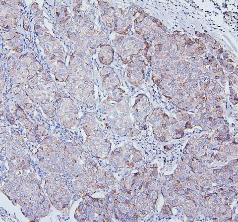 Anti-TRPV3 Antibody Picoband® Boster Bio